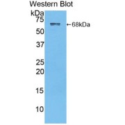 Western blot analysis of the recombinant protein.