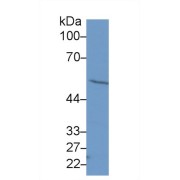 Western blot analysis of Human HeLa cell lysate, using Human FSCN Antibody (1 µg/ml) and HRP-conjugated Goat Anti-Rabbit antibody (<a href="https://www.abbexa.com/index.php?route=product/search&amp;search=abx400043" target="_blank">abx400043</a>, 0.2 µg/ml).