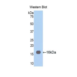 Fascin (FSCN) Antibody