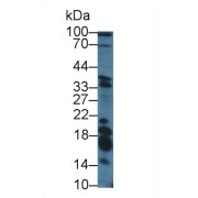 Western blot analysis of Human 293T cell lysate, using Human GAL Antibody (3 µg/ml) and HRP-conjugated Goat Anti-Rabbit antibody (<a href="https://www.abbexa.com/index.php?route=product/search&amp;search=abx400043" target="_blank">abx400043</a>, 0.2 µg/ml).