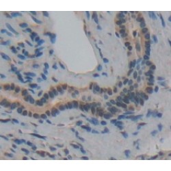 Galanin (GAL) Antibody