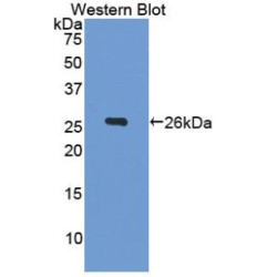 Gelsolin (GSN) Antibody