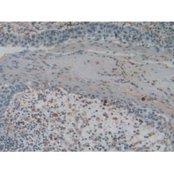 Gelsolin (GSN) Antibody