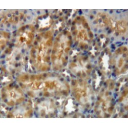 Gelsolin (GSN) Antibody