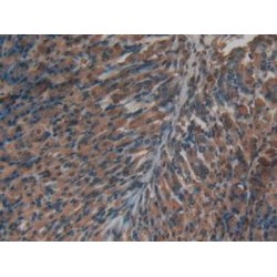 Insulin (INS1) Antibody
