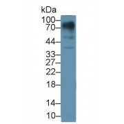 Western blot analysis of Human Lung lysate, using Human LUM Antibody (1 µg/ml) and HRP-conjugated Goat Anti-Rabbit antibody (<a href="https://www.abbexa.com/index.php?route=product/search&amp;search=abx400043" target="_blank">abx400043</a>, 0.2 µg/ml).
