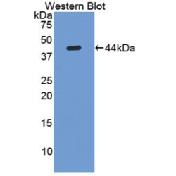 Lumican (LUM) Antibody