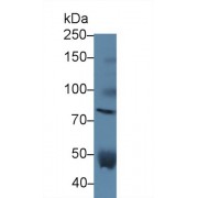 Western blot analysis of Human Serum, using Human VS Antibody (5 µg/ml) and HRP-conjugated Goat Anti-Rabbit antibody (<a href="https://www.abbexa.com/index.php?route=product/search&amp;search=abx400043" target="_blank">abx400043</a>, 0.2 µg/ml).