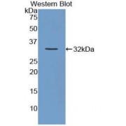 Western blot analysis of recombinant Mouse Versican.