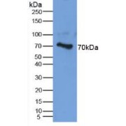 abx100122