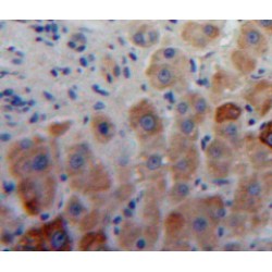 Aggrecan Core Protein (ACAN) Antibody