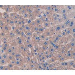 Aggrecan Core Protein (ACAN) Antibody