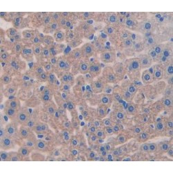 Aggrecan Core Protein (ACAN) Antibody