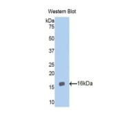 abx100126