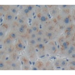 Biglycan (BGN) Antibody