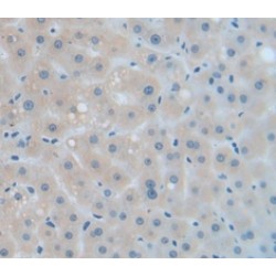 Catalase (CAT) Antibody