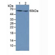 Western blot analysis of (1) Mouse Liver Tissue and (2) Mouse Kidney Tissue.