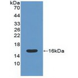 Catalase (CAT) Antibody