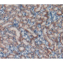 Catalase (CAT) Antibody