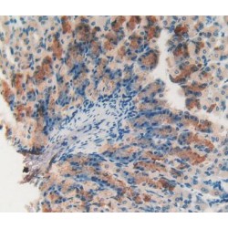 Catalase (CAT) Antibody
