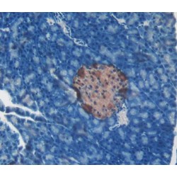 Catalase (CAT) Antibody