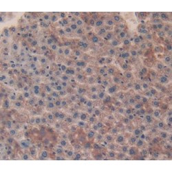 Catalase (CAT) Antibody