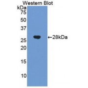 Western blot analysis of recombinant Human CHRD.