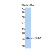 Western blot analysis of recombinant Human CUBN.