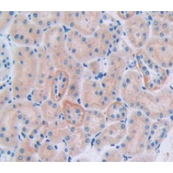 Cubilin (CUBN) Antibody