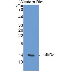 Endoglin / CD105 (ENG) Antibody