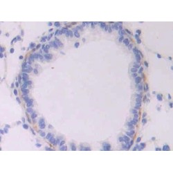 Endoglin / CD105 (ENG) Antibody