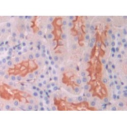 Endoglin / CD105 (ENG) Antibody