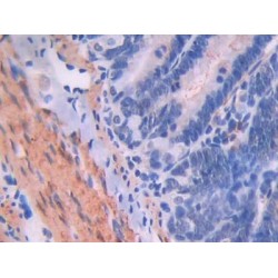 Endoglin / CD105 (ENG) Antibody