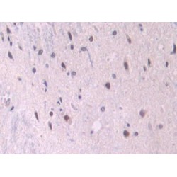 Endoglin / CD105 (ENG) Antibody