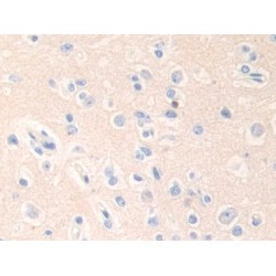Epsin 1 (EPN1) Antibody