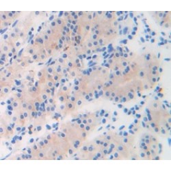 Ghrelin (GHRL) Antibody