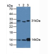 Western blot analysis of (1) Human Lung Tissue, (2) Human Liver Tissue and (3) Rat Kidney Tissue.