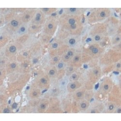 Lysozyme (LZM) Antibody