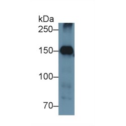 Nephrin (NPHN) Antibody
