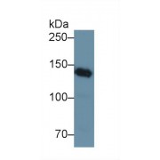Western blot analysis of Rat Kidney lysate, using Human NPHN Antibody (1 µg/ml) and HRP-conjugated Goat Anti-Rabbit antibody (<a href="https://www.abbexa.com/index.php?route=product/search&amp;search=abx400043" target="_blank">abx400043</a>, 0.2 µg/ml).