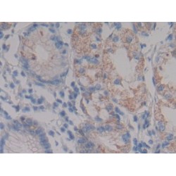 Nephrin (NPHN) Antibody