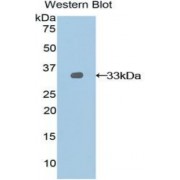 Western blot analysis of recombinant Rat NEXN.