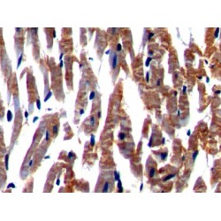 Nexilin (NEXN) Antibody