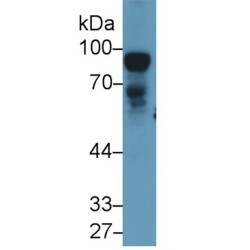 Nexilin (NEXN) Antibody