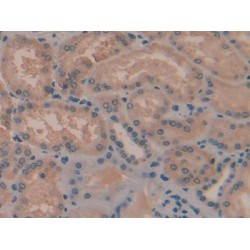 Tafazzin (TAZ) Antibody
