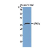 Western blot analysis of the recombinant protein.