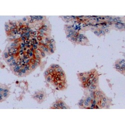 Vimentin (VIM) Antibody