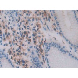 Chemerin (RARRES2) Antibody