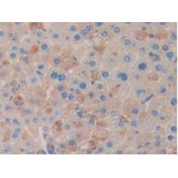 Clusterin (CLU) Antibody