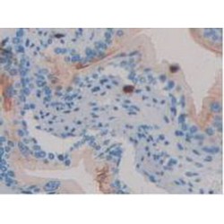 Clusterin (CLU) Antibody